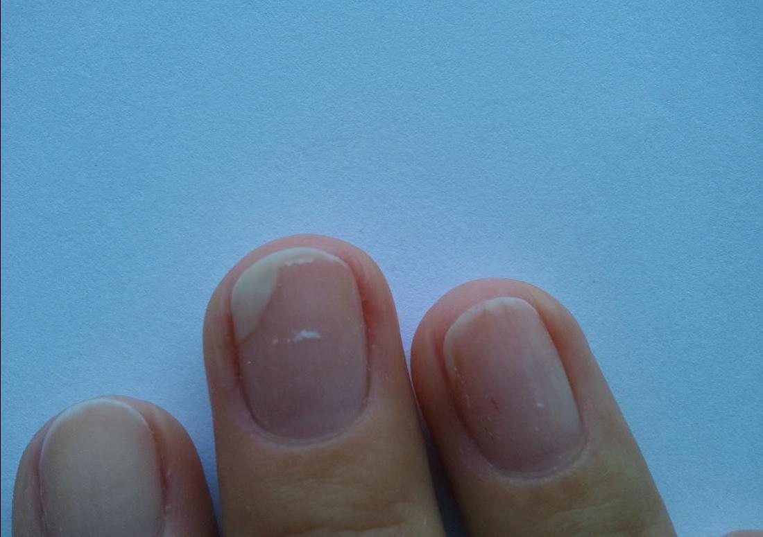 What's with the nails? (girls, under the cut is not aesthetic photos) - review