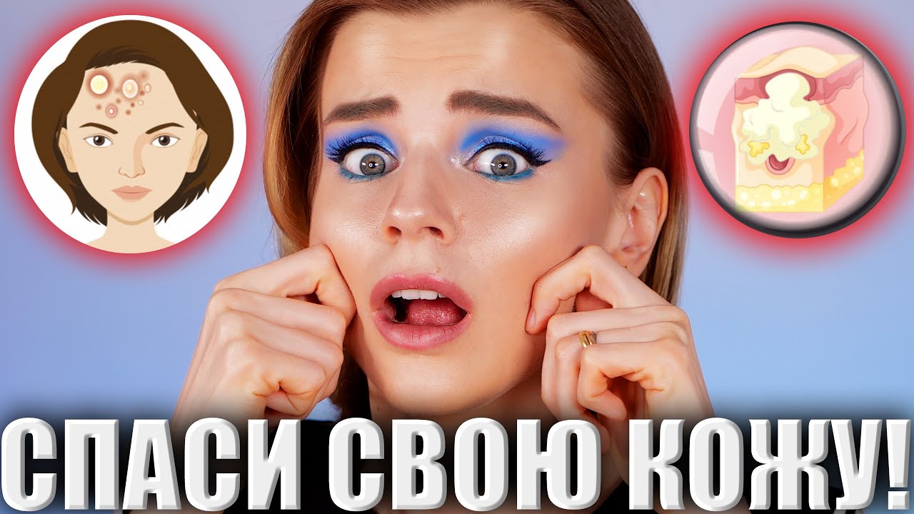 Как избавиться от прыщей? Ошибки в уходе за кожей!