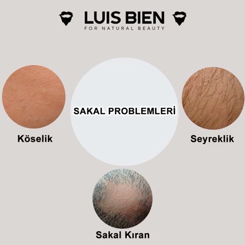 Luis Bien - Seyrek sakallarınızın nasıl sıklaşacağı konusunda, köse sakallarınızın nasıl çıkacağı konusunda, sakal kıran probleminin nasıl çözüleceği hakkında yolunuzu kaybetmiş gibi hissediyorsanız t...