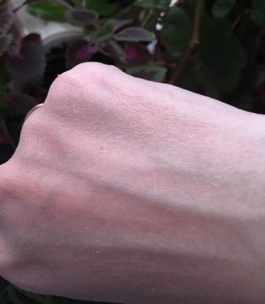 Сухая кожа рук
