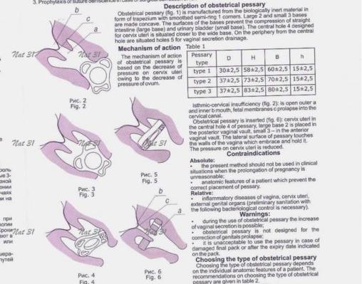 Пессарий акушерский юнона отзывы 98