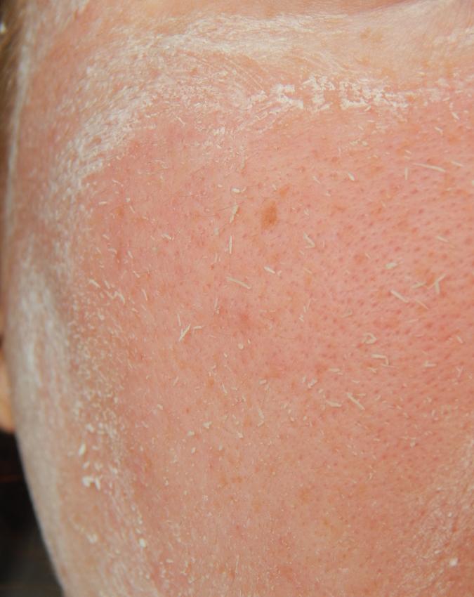 Отзыв. Пилинг для лица Christina Peeling Gommage with Vitamin E4 Пилинг для лица Christina Peeling Gommage with Vitamin E