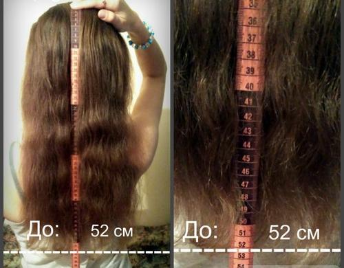 Длина волос до применения капсул Trichup