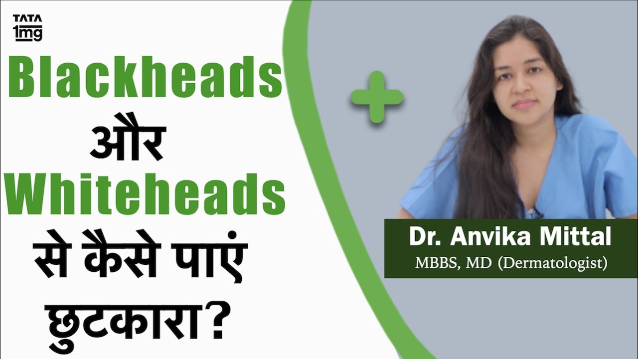Blackheads और Whiteheads कैसे हटाए? कारण और इलाज? - Dr. Anvika Mittal