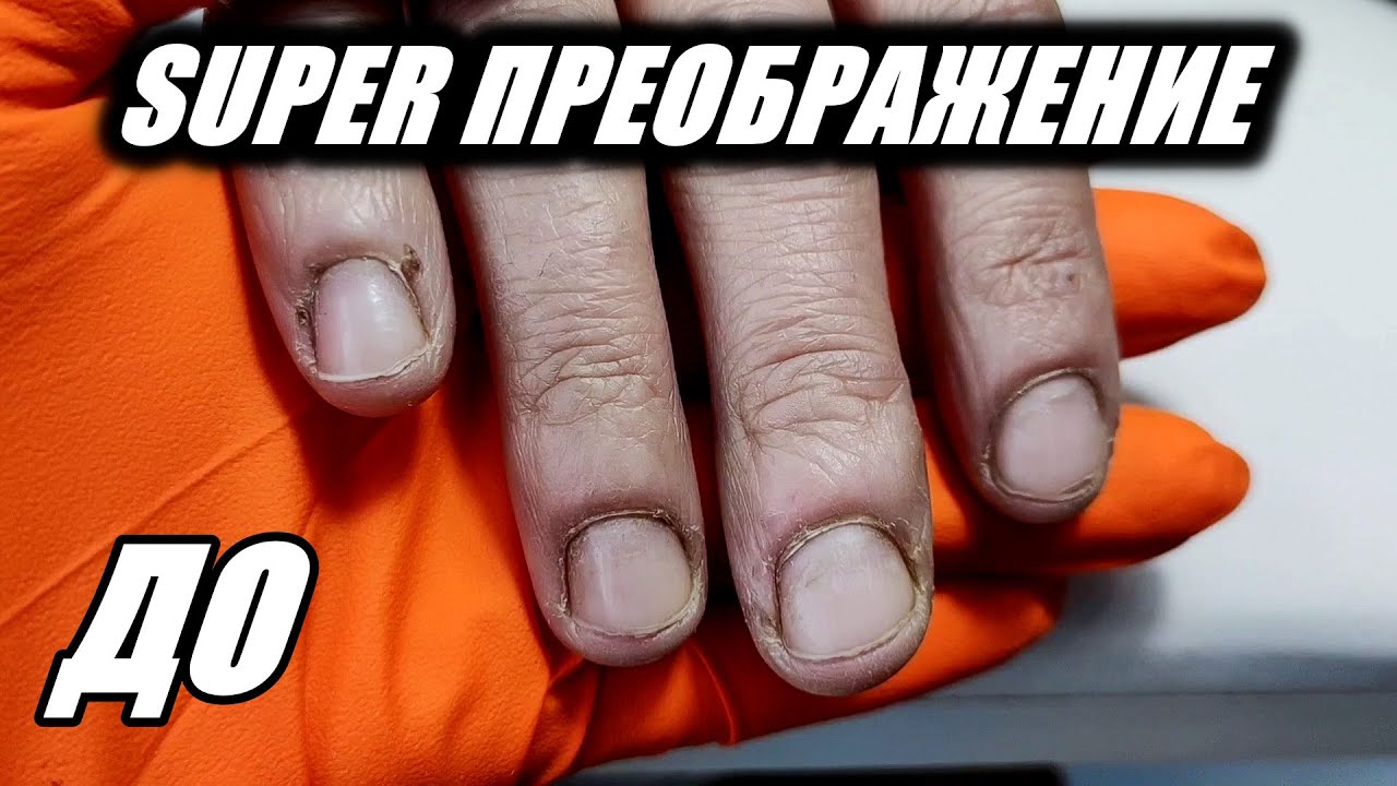 SUPER ПРЕОБРАЖЕНИЕ НОГТЕЙ ГРЫЗУНЧИКА💥