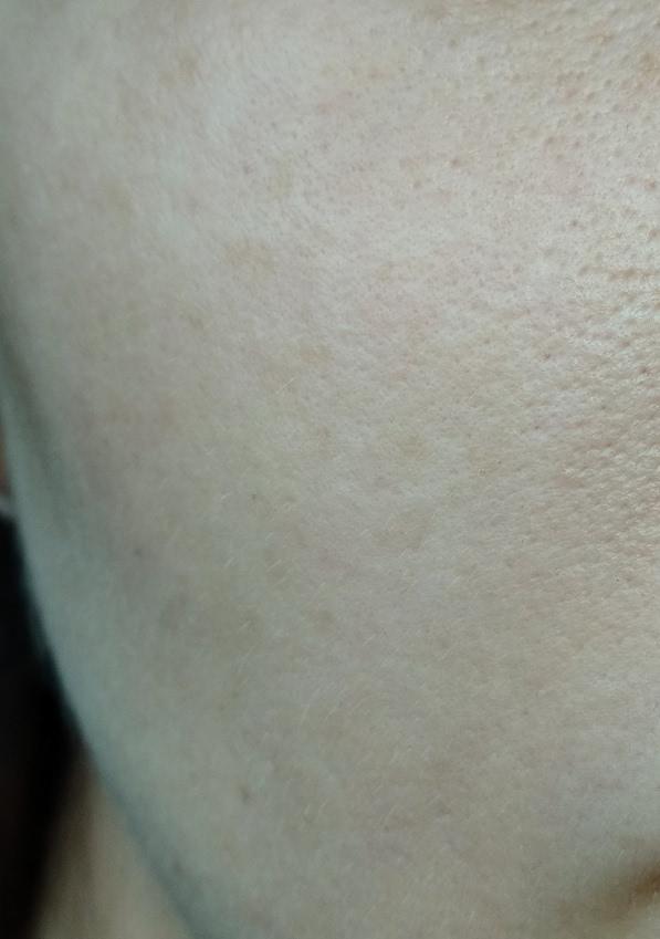 Отзыв. Secret KEY Hyaluron Soft Micro-Peel Toner - мощное увлажнение и кислоты12 6605a1_lbox.jpg