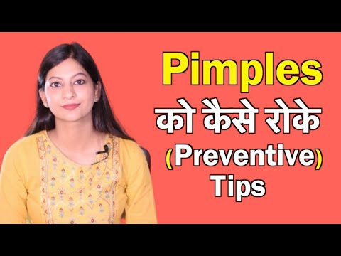 Acne कैसे हटाये? क्यों होता है Acne? Best Pimples Treatment